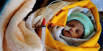 A baby born preterm in a hospital in Addis Ababa, Ethiopia. 