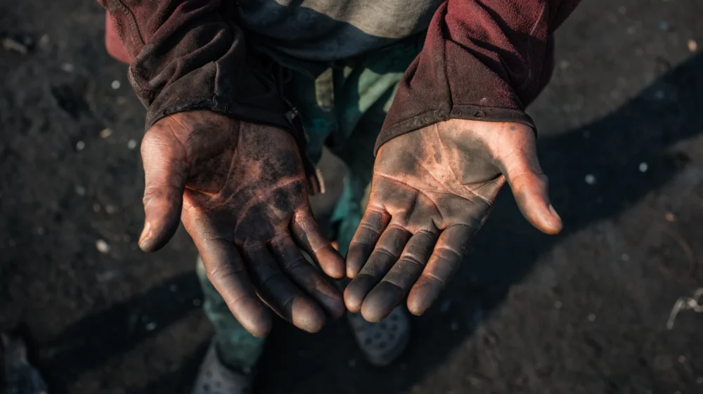 Peter Akpos's hands are covered in soot from the abattoir. Peter is a roaster who has worked for 18 years at AGIP abattoir in Port Harcourt, where cow skins are burned over open fires. Peter is exposed to thick smoke almost every day as part of his work. Despite the health risks, Peter continues this labor to support himself and his family, reflecting the daily realities of workers in the local meat processing industry. Rivers State, Nigeria. January 6 2026.